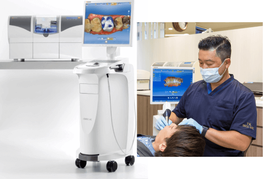 CEREC セレック①