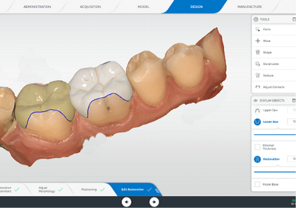 CEREC セレック③