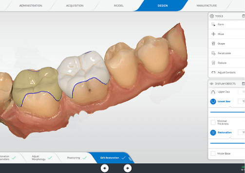 CEREC セレック③