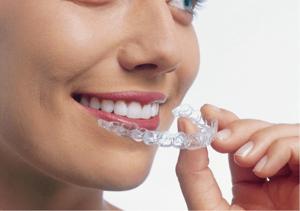 池袋の歯医者・歯科西池袋TKデンタルクリニックのマウスピース矯正